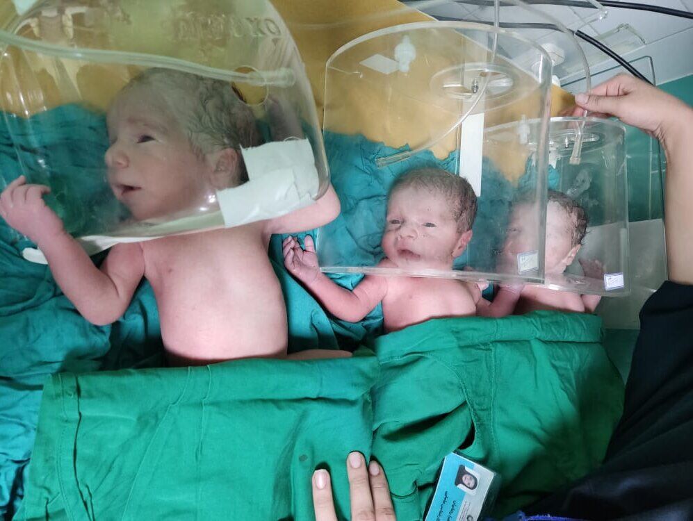 تولد نوزادان سه قلو در گچساران+عکس